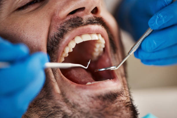 Best After-Hours Dental Care in Potosi, TX